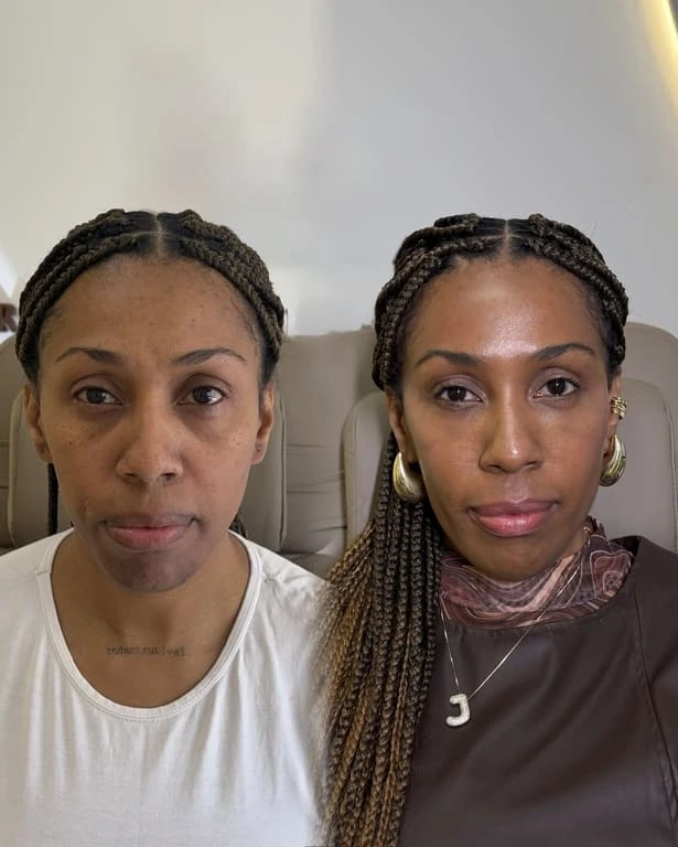 Comparação frontal de proporções faciais