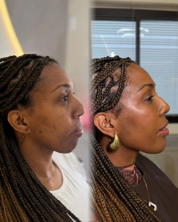 Comparação lateral de proporções faciais